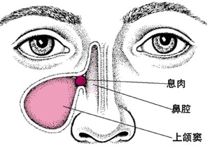 治鼻竇炎藥效果好嗎